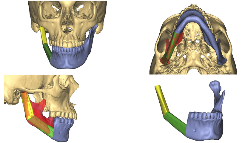 images of skull with jaw labeled in different colors