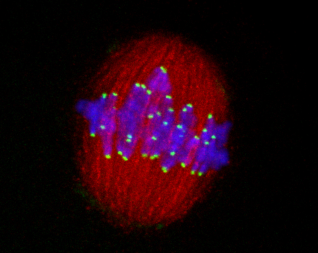 Image of cell undergoing cell division with fluorescent labeled chromosomes
