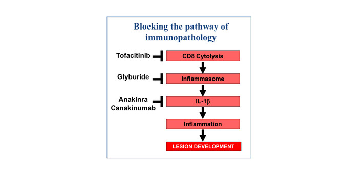 Leishmaniasis pathway