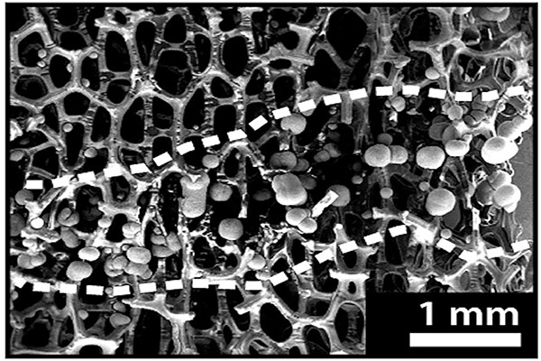 a microscopic view of bone metal
