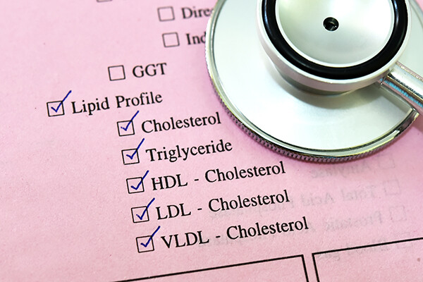Lipid panel with check marks with a stethoscope resting on top of the file.