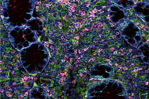 Microscopic multicolor image of a colon.