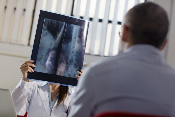 Doctor holding up an X-ray of a spine in front of a patient, seated.
